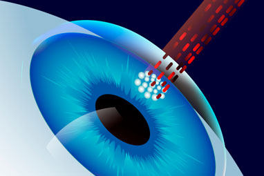Collagen Crosslinking