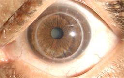 Cornea & Ocular Surface in Kharadi, Pune